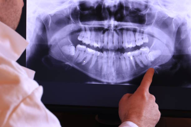 Best Orthodontic Emergency Dentist in Jacksonville, TX