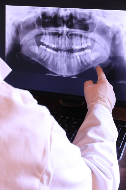 Best Emergency Root Canal Treatment in Jacksonville, TX