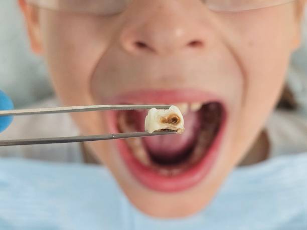 Best Urgent Dental Care for Toothache in Jacksonville, TX